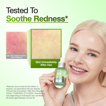 Anua Azelaic Acid 10 Hyaluron Redness Soothing Serum, Facial Serum for Blemish-Prone & Oily-Prone Skin, Lightweight & Hydrating Blemish Care