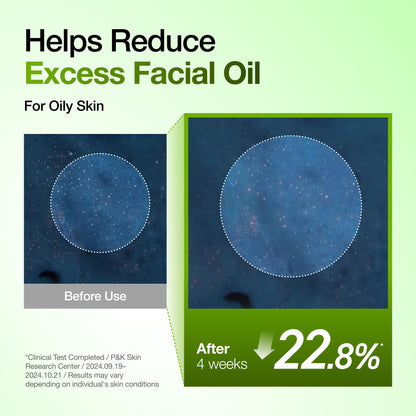Anua Azelaic Acid 10 Hyaluron Redness Soothing Serum, Facial Serum for Blemish-Prone & Oily-Prone Skin, Lightweight & Hydrating Blemish Care